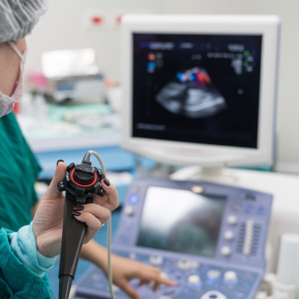 What Happens During an Echocardiogram?